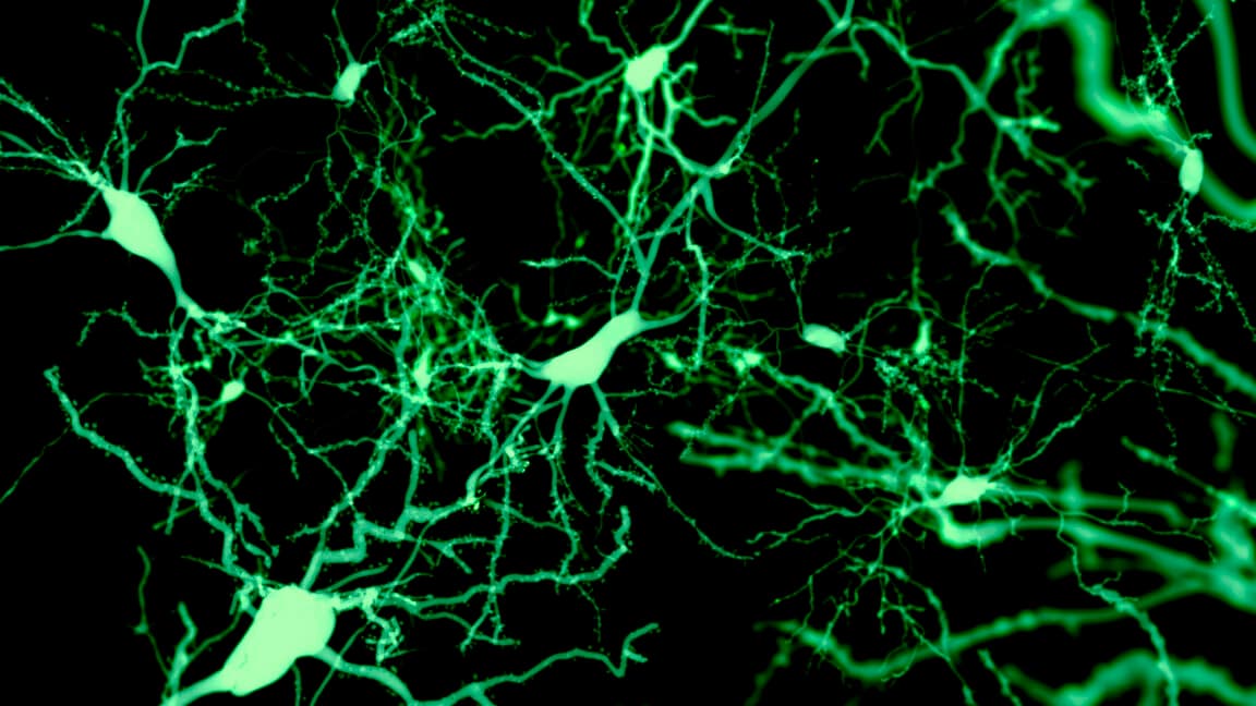 Scientists Map the Brain's On-Off Switch for Sleep