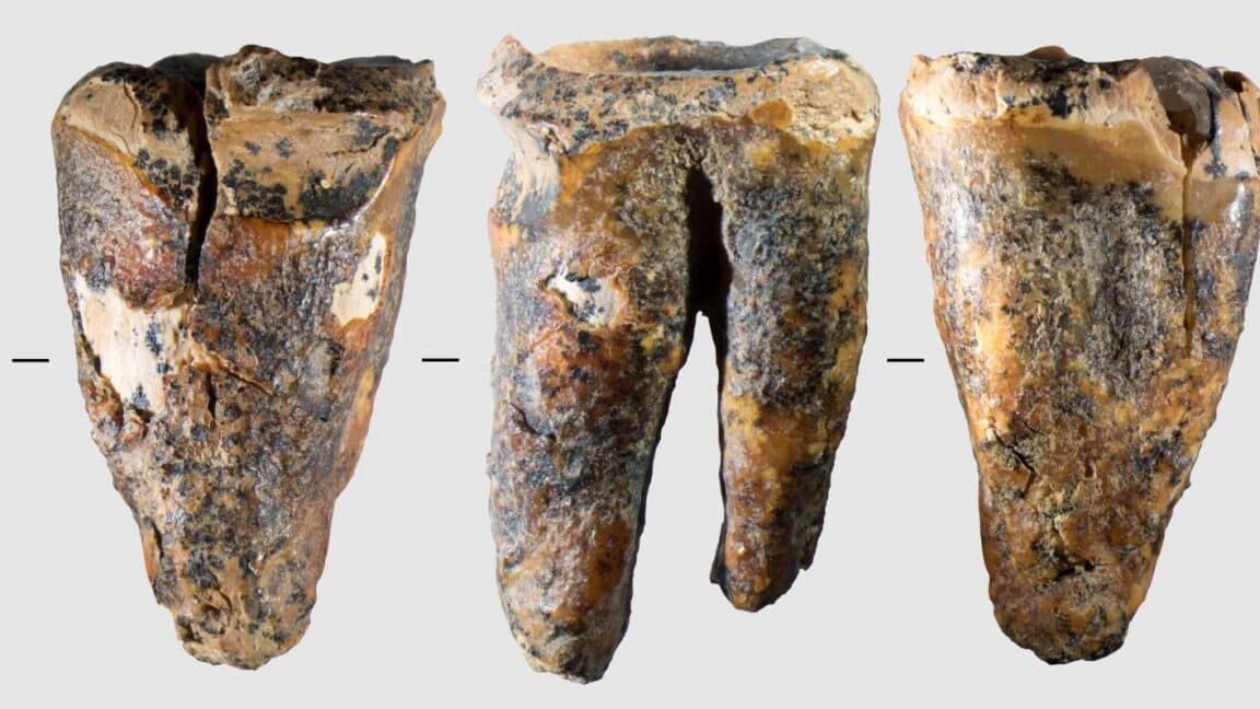Neanderthals performed dental surgery 59,000 years ago